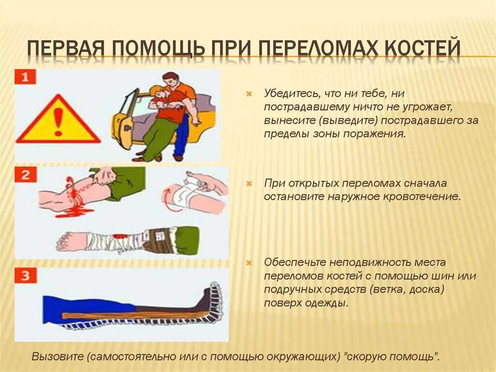 Алгоритм при открытом переломе. Перелом и оказание первой медицинской помощи при переломе. При оказании первой медицинской помощи при переломе. Порядок оказания первой помощи при переломах. Переломы костей конечностей действия по оказанию первой помощи.