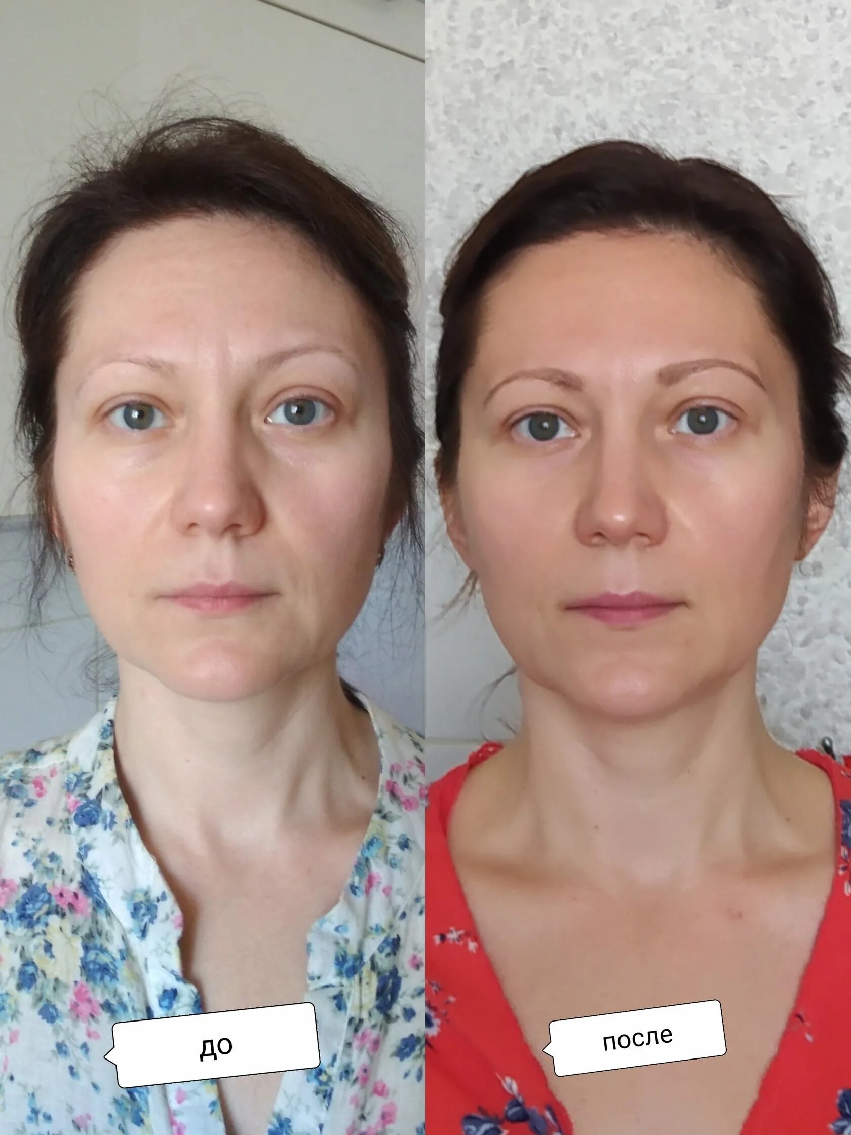 массаж лица до и после фото. массаж лица до и после. массаж лица гуаша картинки. массаж лица. массаж лица гуаша до и после.