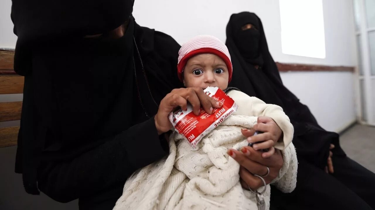 Дети в Йемене недоедают. Арабские дети.