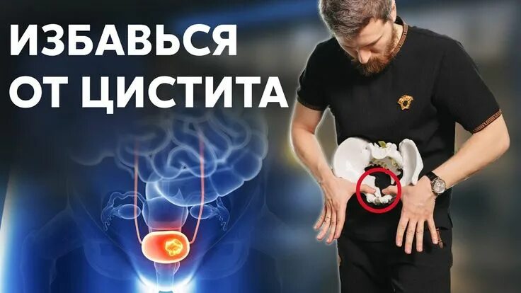 Как снять цистит в домашних условиях Неосложненные инфекции нижних мочевых путей у взрослых обзор обновленных клини
