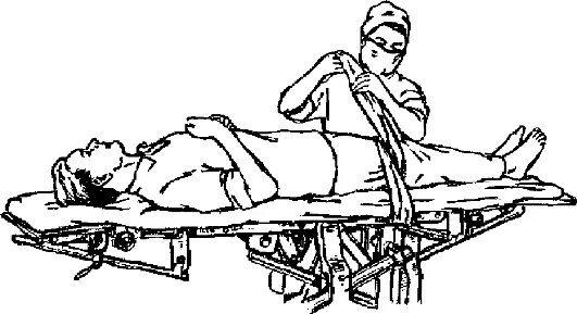 Положение больного на столе. Фиксация пациента на операционном столе. Пациент на операперационном столн. Положение пациента на операционном столе. Пациент на операционном столе.