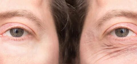 The skin around the eyes
