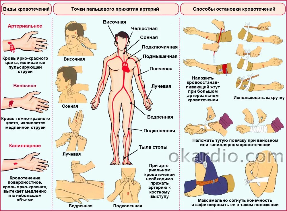 Как повысить пульс у пожилого человека. Способы остановки кровотечения. Метод пальцевого прижатия артерий. Точки пальцевого прижатия артерий. Как поднять давление и пульс быстро.