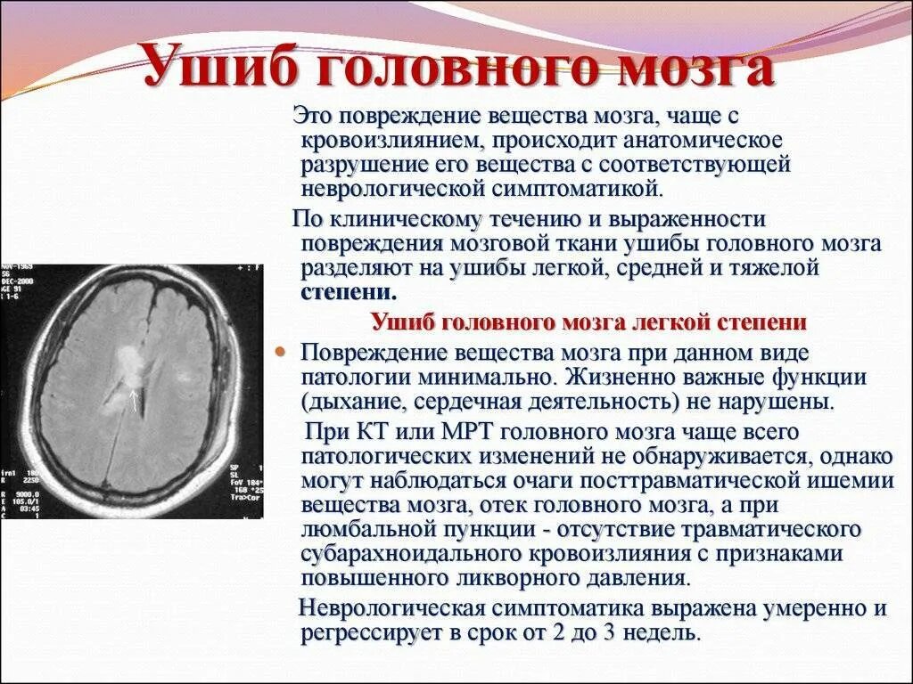 Последствия после сотрясения. Ушиб головного мозга головного мозга. терапия сотрясения головного мозга. проявления ушиба головного мозга. при сотрясении головного мозга.