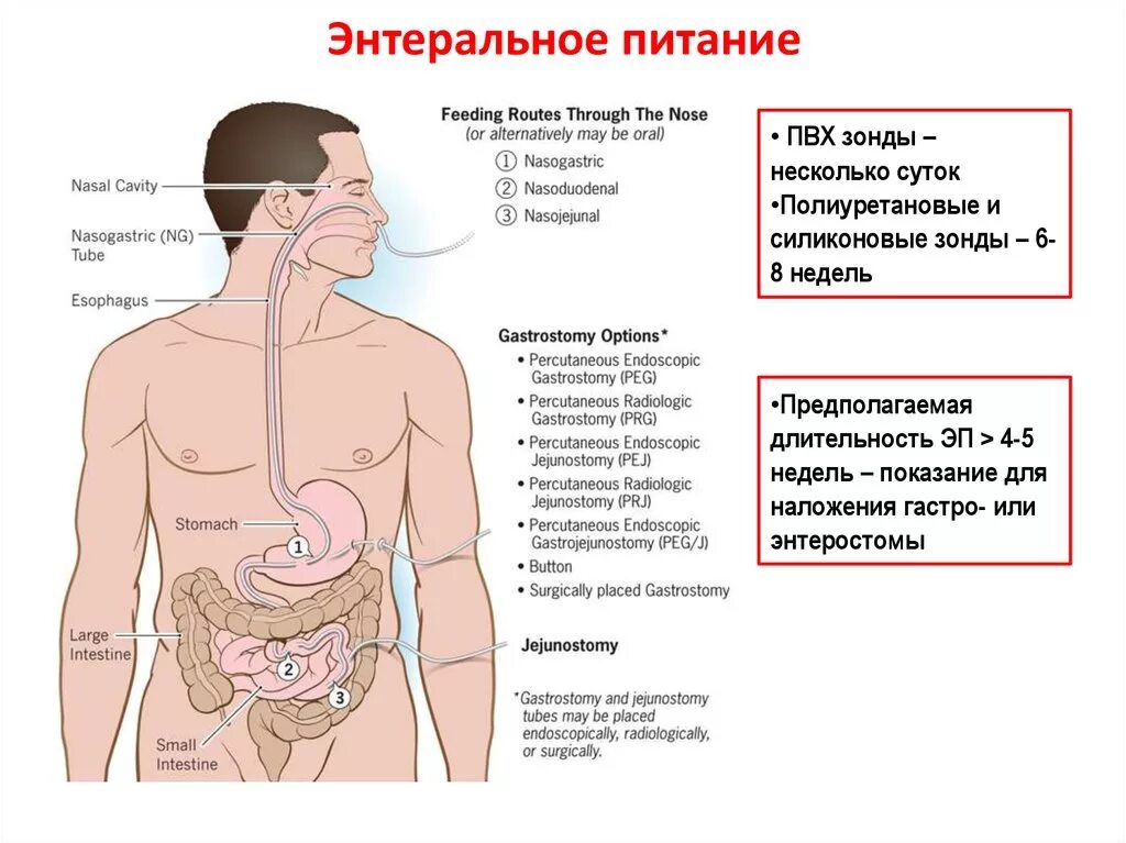 Энтеральное через рот. Методы энтерального питания. зондовое энтеральное питание. искусственное энтеральное питание. энтеральное питание больных зондовое.