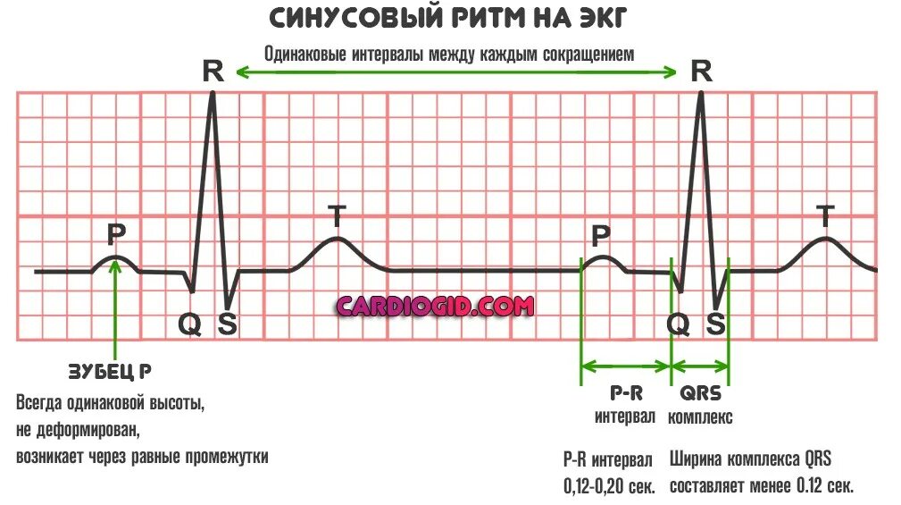 ЭКГ нормальные синусовый ритм норма. ЭКГ признаки нормального сердечного ритма. ЭКГ расшифровка синусовый ритм. Кардиограмма сердца расшифровка синусовый ритм норма.