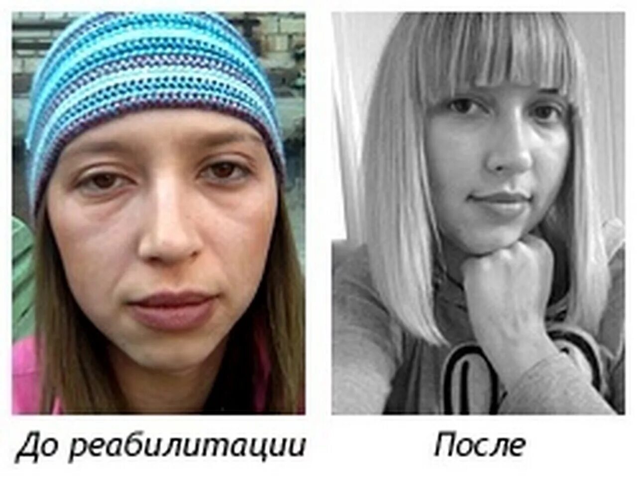 После меням. Лица женщин алкоголичек до и после. Лицо алкоголика до и после. Лицо наркомана до и после реабилитации.