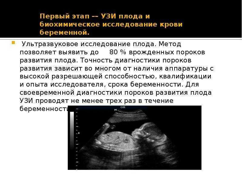 Может ли узи ошибаться с диагнозом. Ультразвуковое исследование плода. узи исследование плода. ультразвуковое узи плода. ультразвуковое исследование (узи) плода.