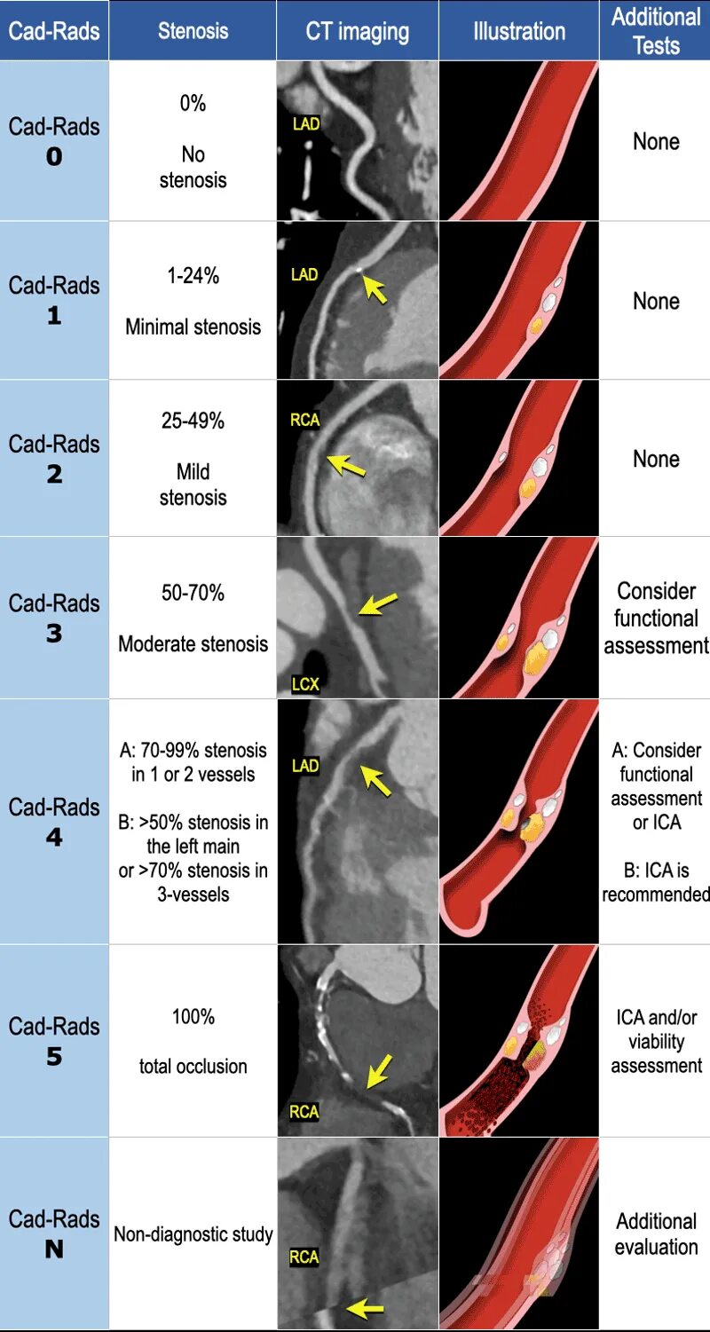 CAD-rads 5. CAD rads классификация. CAD rads шкала. O rads классификация. O rads слева 1