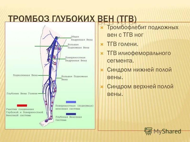 Мкб 10 тромбоз глубоких вен нижних. Тромбофлебит малой подкожной вены. Тромбоз глубоких вен (ТГВ) – что это такое?. Тромбоз подкожных вен нижних конечностей.