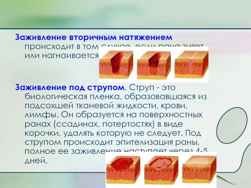 Что происходит под