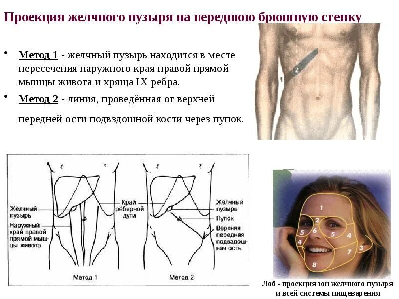 Желчно-каменная болезнь. Острый холецистит - презентация онлайн