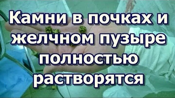 Ли растворить камни в желчном пузыре. Препараты для растворение жельчных камней. Лекарство для растворения камней в желчном. Препараты для растворения камней в желчном пузыре. Растворение камней в желчном пузыре.