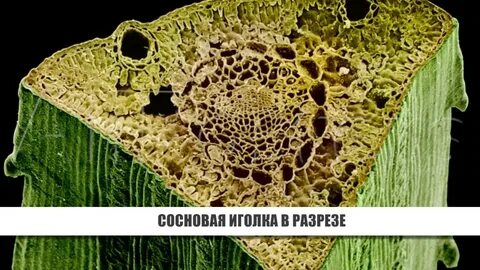 Хвоинка под микроскопом