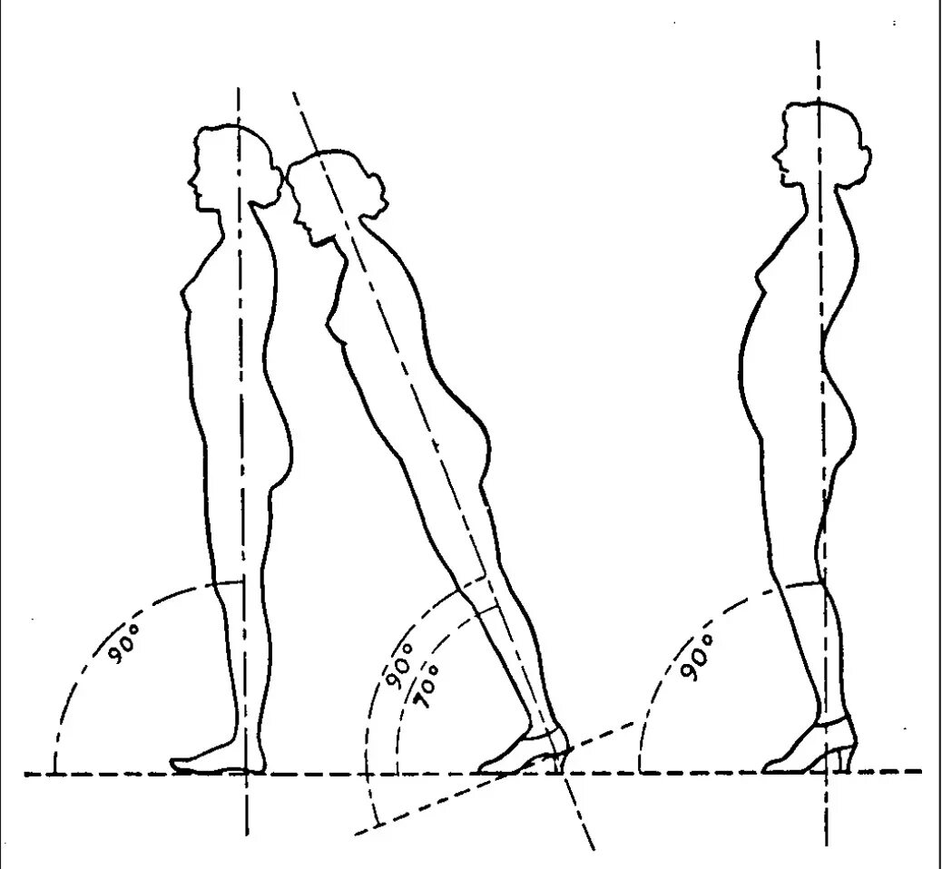 Биомеханика ходьбы человека. Распределение нагрузки на позвоночник. Нагрузка на позвоночник стоя. Распределение нагрузки на стопу. Изменение положения женщины