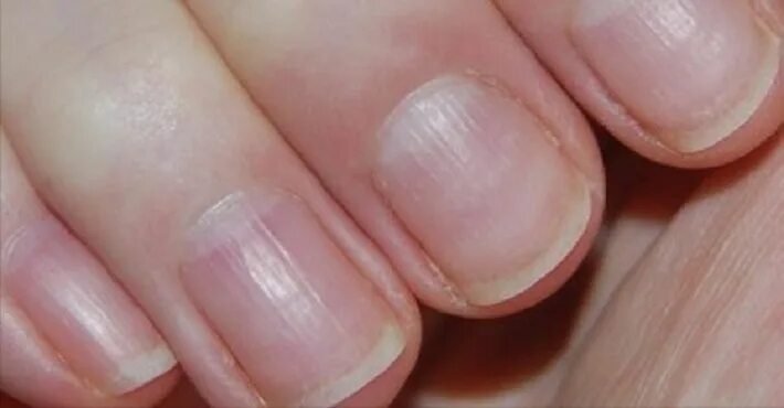 Pin by skovorodnikov_vanya on Health Nail health, Healthy nails, Manicure