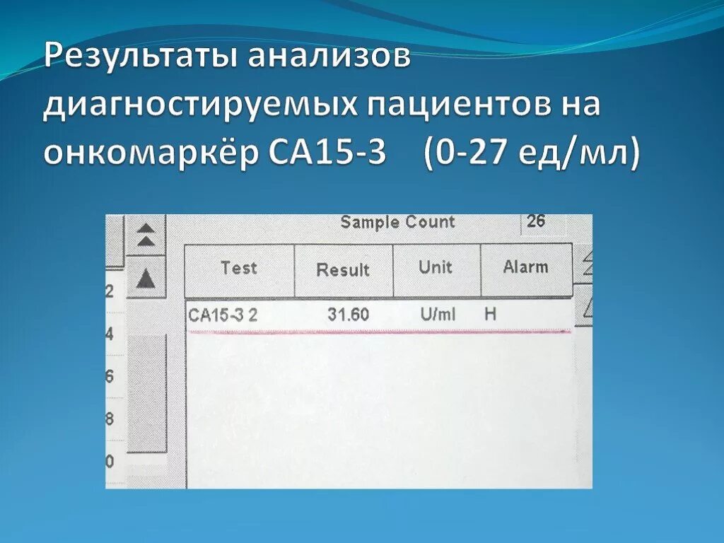 Анализ са-15-3 норма. Исследования анализа CA 15-3 нормы. Нормы онкомаркеров у женщин са 15-3. Онкомаркер 15-3 норма.