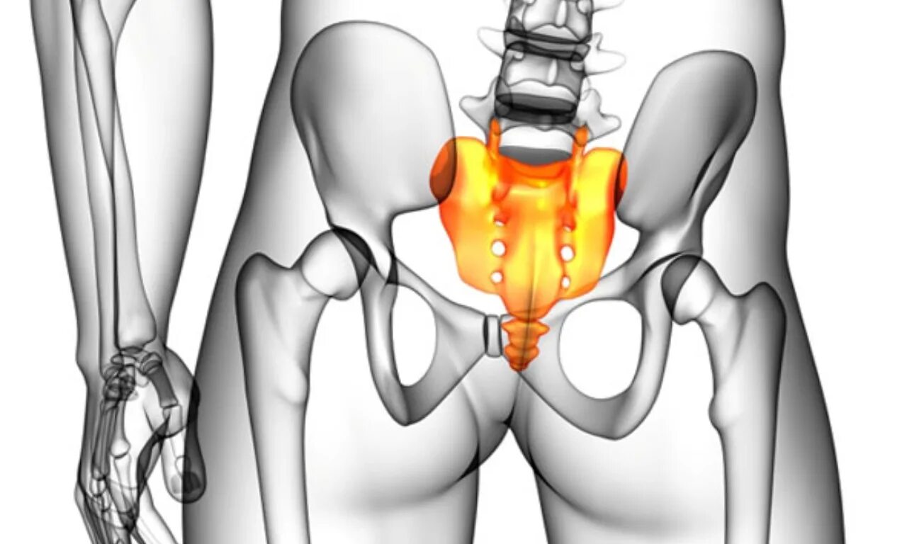 Сильные боли в области таза. Артроз крестцово-копчикового сочленения. Перелом копчика анатомия.