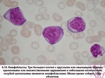 Лимфобласты