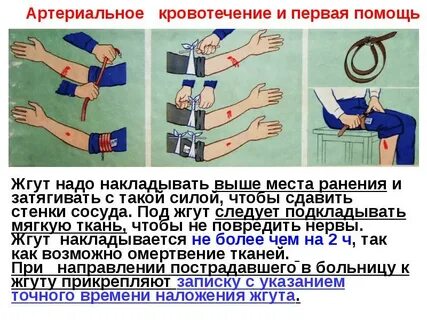 Жгут предплечья