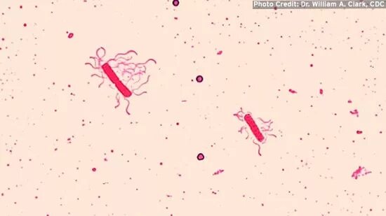 Ожешко микробиология. Bacillus cereus ожешко. окраска по ганзену. флагелла микробиология. окраска по ауески микробиология.