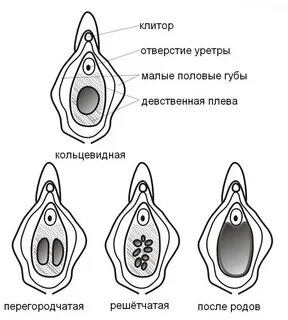 Девственная плева: что это и как она выглядит? 