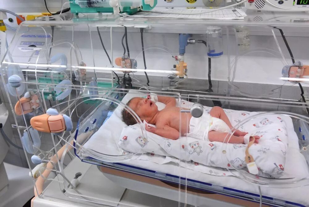 Как называются дети рожденные. Кувез для детей кювез недоношенных. Кувезы для новорожденных. Перинатальный центр кувезы.