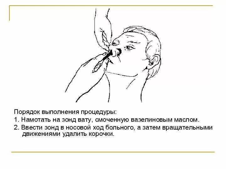 Проведение процедуры не входит в