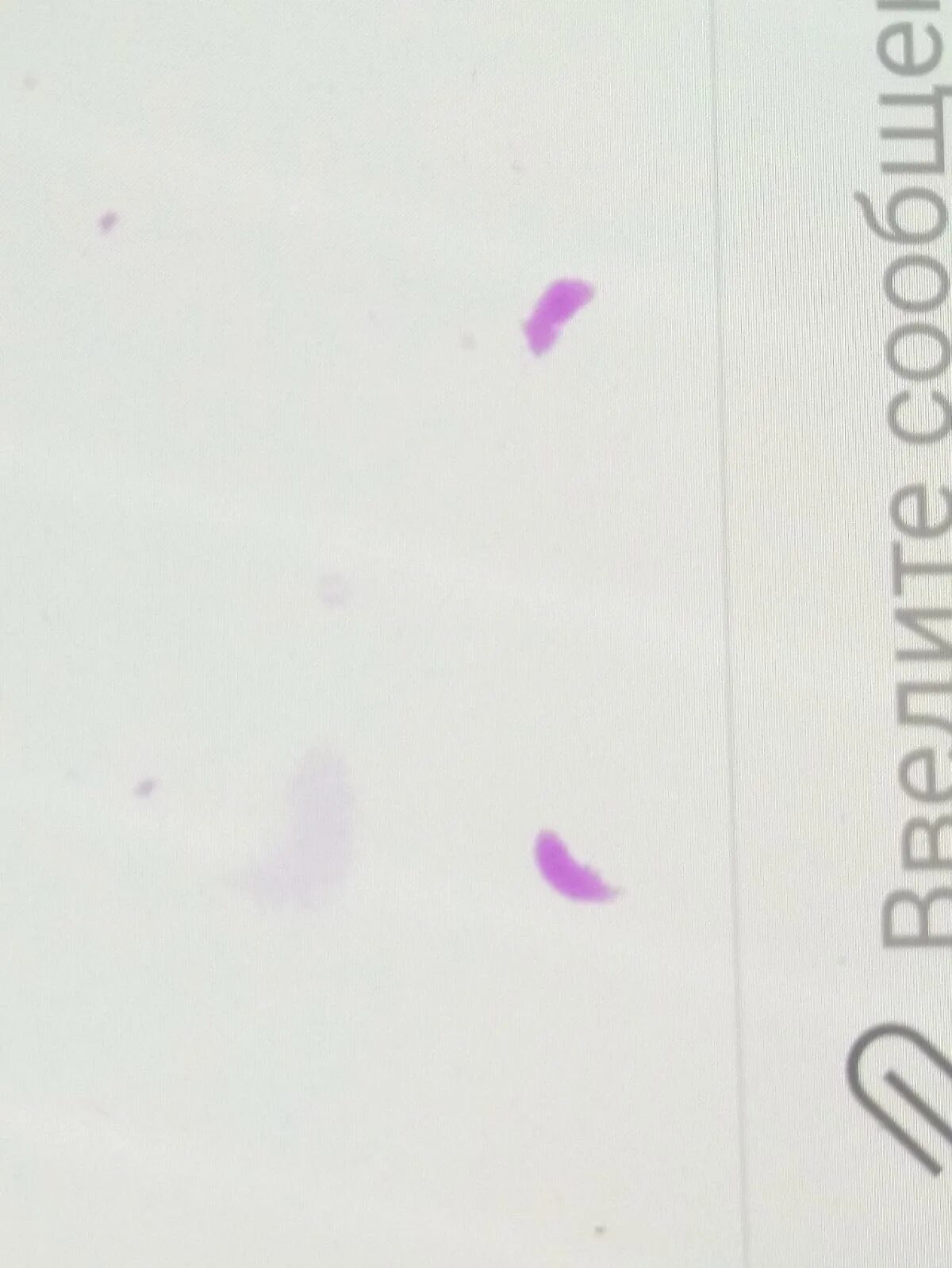 Фиолетовые пятна на экране смартфона. Фиолетовое пятно на экране телефона. Фиолетовое пятно на экране телевизора samsung. Фиолетовые пятна на экране смартфона. Тёмное пятно на экране смартфона.