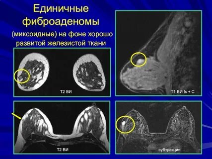 Единичные железы