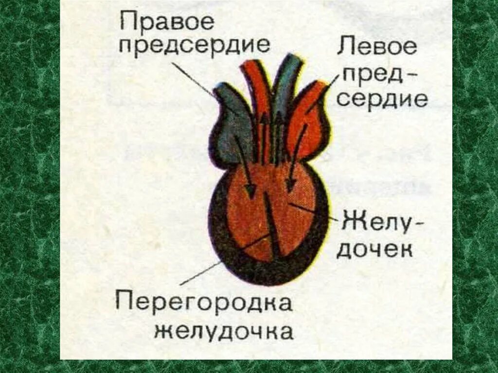 Трехкамерное сердце с неполной перегородкой в желудочке. Неполная перегородка в желудочке сердца. Этрехкамеиное сердце с неполной перегородок в жедудочке. Трехкамерное без перегородки в желудочке.