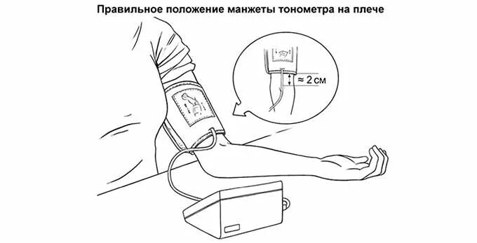 Манжету тонометра накладывают на. Как правильно надевать манжету тонометра. Как одеть манжет на руку. Тонометр microlife bp a6 pc afib. Правильная манжета для тонометра.