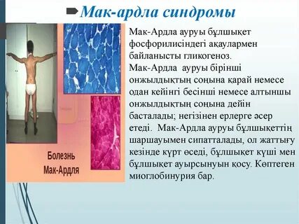 Синдром мака