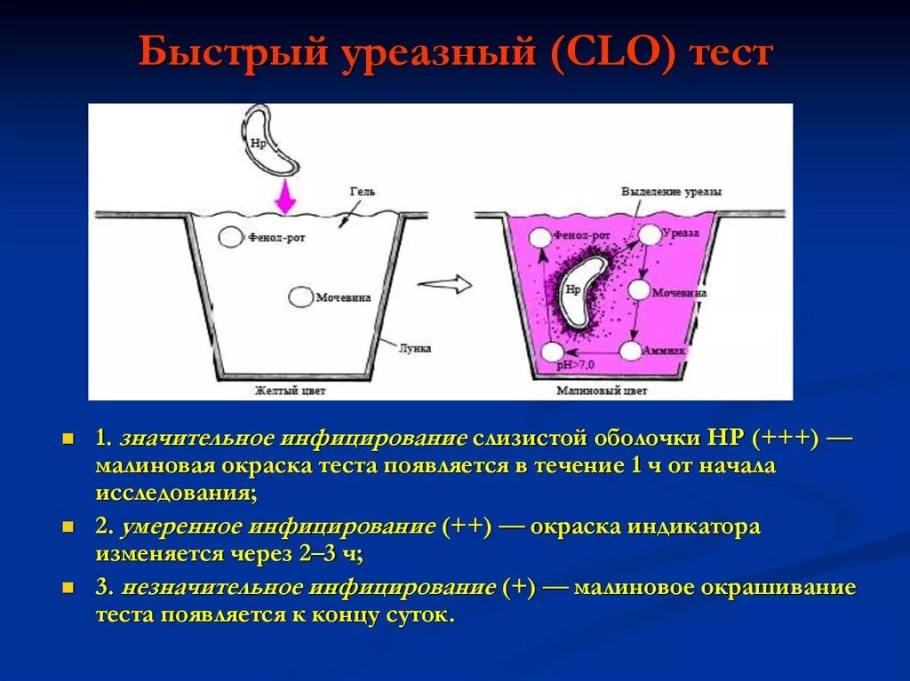 Уреазный экспресс тест. Быстрый уреазный тест. Биохимический уреазный тест. Быстрый уреазный тест методика. Уреазный тест положительный.