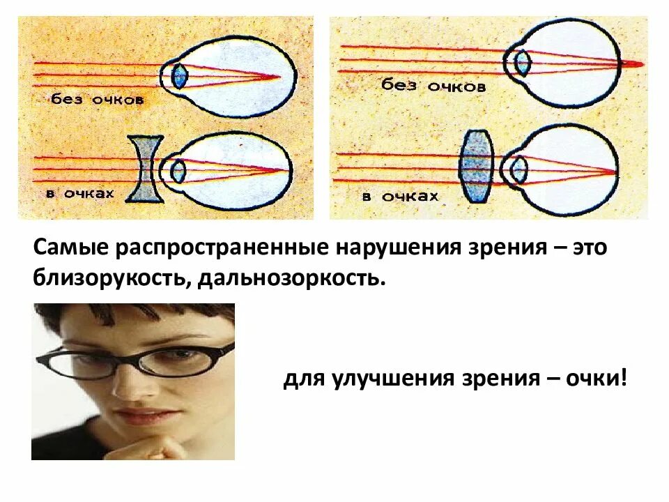 Миша страдает близорукостью а его брат дальнозоркостью. Очки для близорукости. Очки для близорукости и дальнозоркости. Нарушение зрения. Зрение близорукость и дальнозоркость очки.