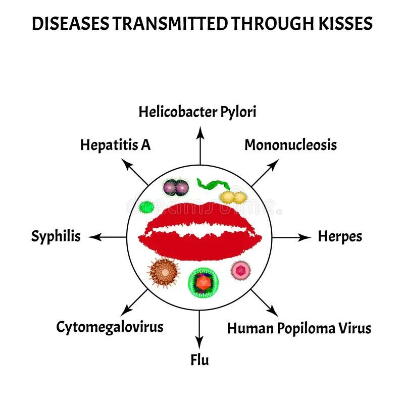 Заболевания передающиеся поцелуями. Хеликобактер пилори передается через поцелуй. Передаётся ли хеликобактер через поцелуй. Вирусы передающиеся через поцелуй. Пути передачи гепатита с через поцелуй.