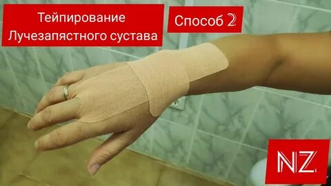 Тейпирование запястья при растяжении