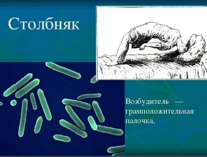 Возбудитель столбняка