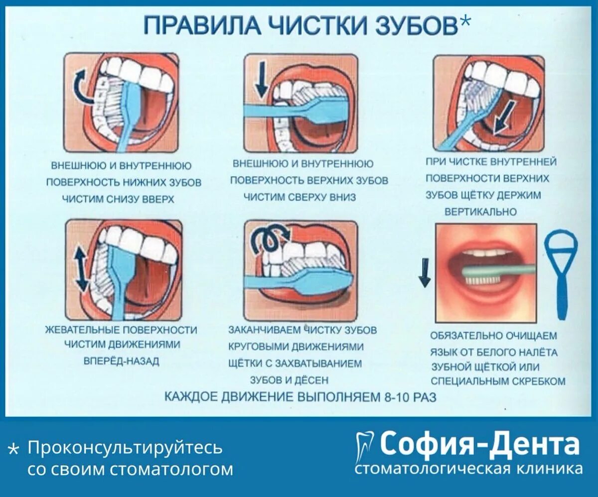 Чистка зуб г. Памятка как правильно чистить зубы. Правильная методика чистки зубов зубной щёткой. Алгоритм стандартного метода чистки зубов. Схема правильной чистки зубов для детей.