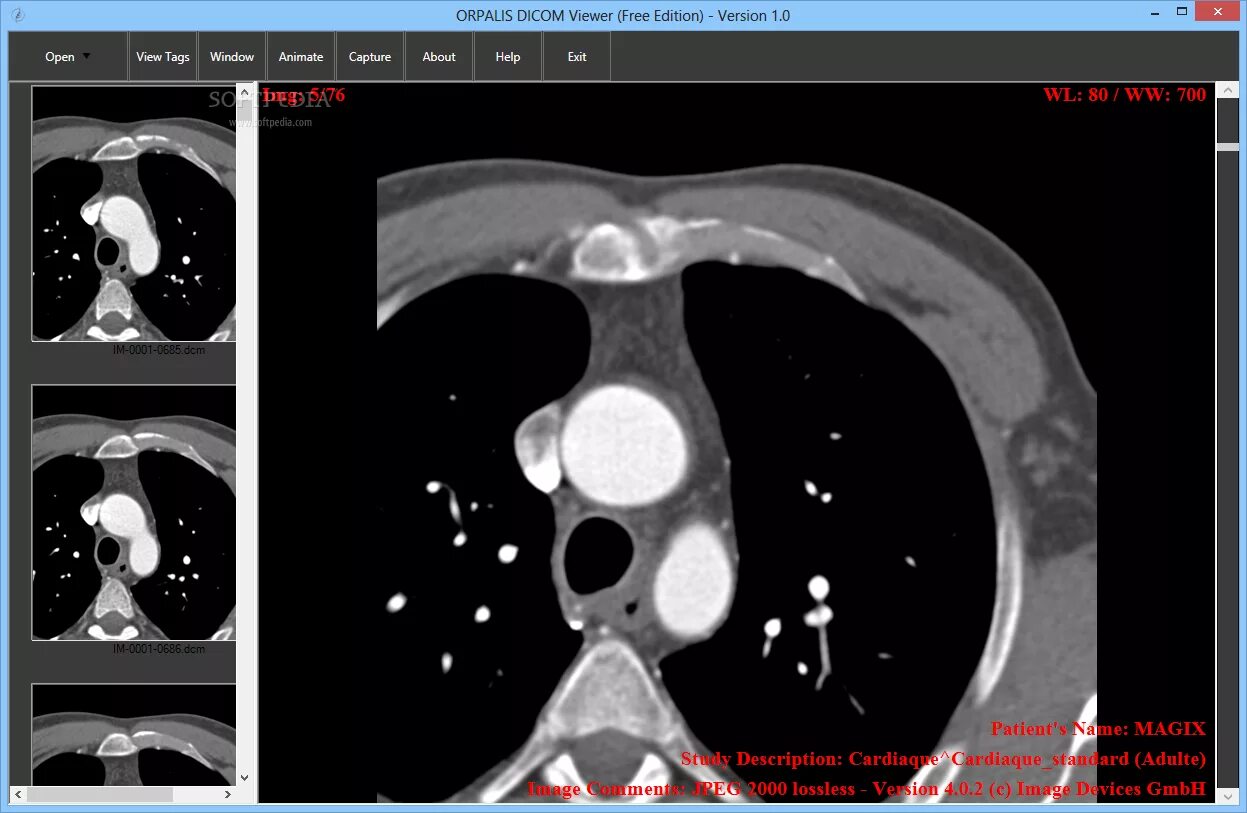 Vidar dicom viewer 3. Dicom viewer. dicom просмотр. просмотрщик кт снимков. программа для просмотра рентгеновских снимков dicom.