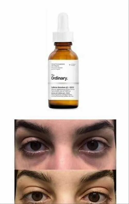 Сыворотка от отеков лица. Сыворотка от отеков лица. Serum для глаз. Сыворотка от отеков лица. Акулий жир сыворотка вокруг глаз.