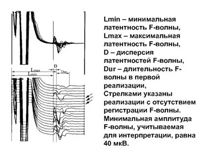 2 и 3 волны не будет