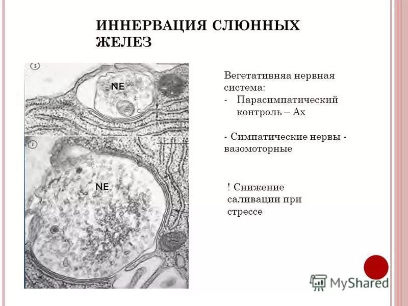 околоушная слюнная железа функции. слюнные железы иннервируются. слюнные железы иннервируются. схема иннервации слюнных желез. нерв иннервирующий подъязычные и поднижнечелюстные слюнные железы.