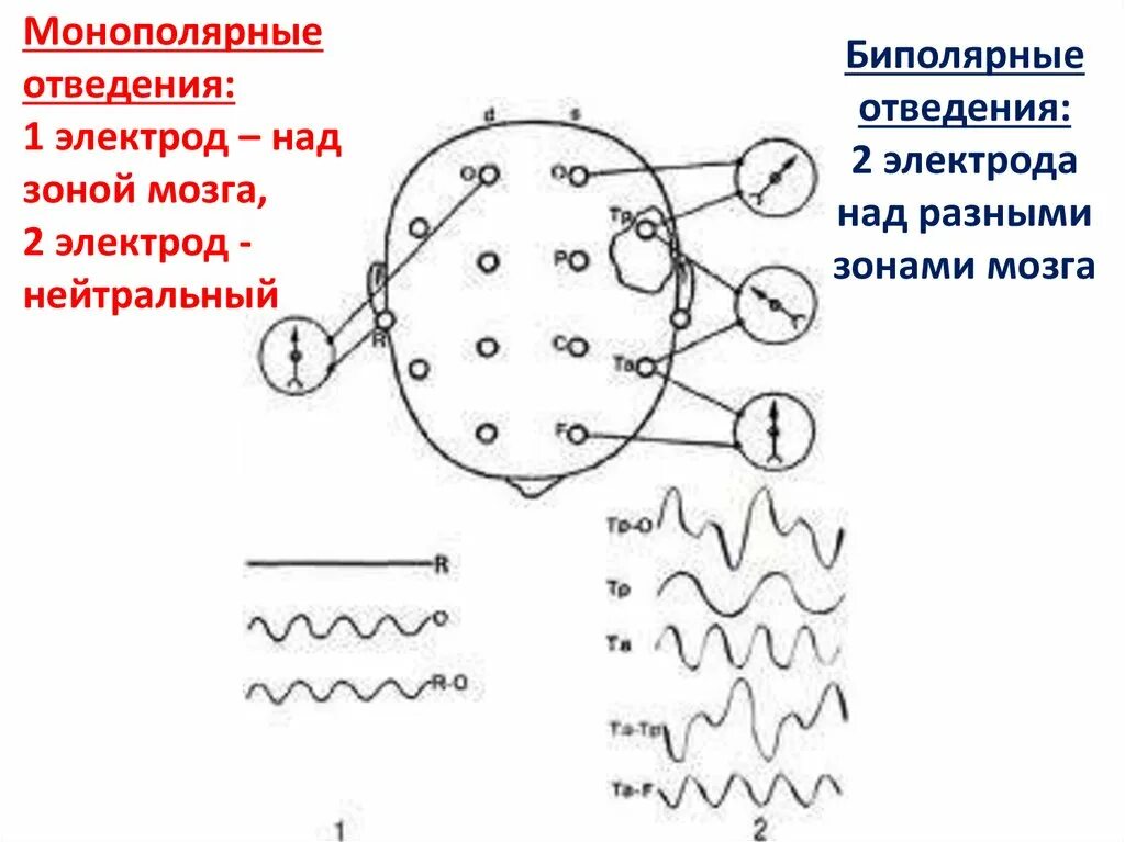 Регистрация ээг. Схема отведений ЭЭГ. ЭЭГ головного мозга наложение электродов. Схема расположения электродов при ЭЭГ 10-20. Схема наложения электродов ЭЭГ.