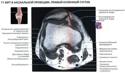 Проекции коленного сустава