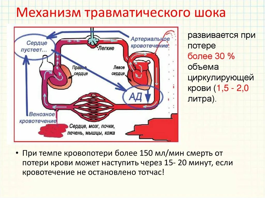 Травматический шок и кровопотеря. Травматический шок. Травматический шок и кровопотеря. Травмы при травматическом шоке. Травматический и геморрагический шок.