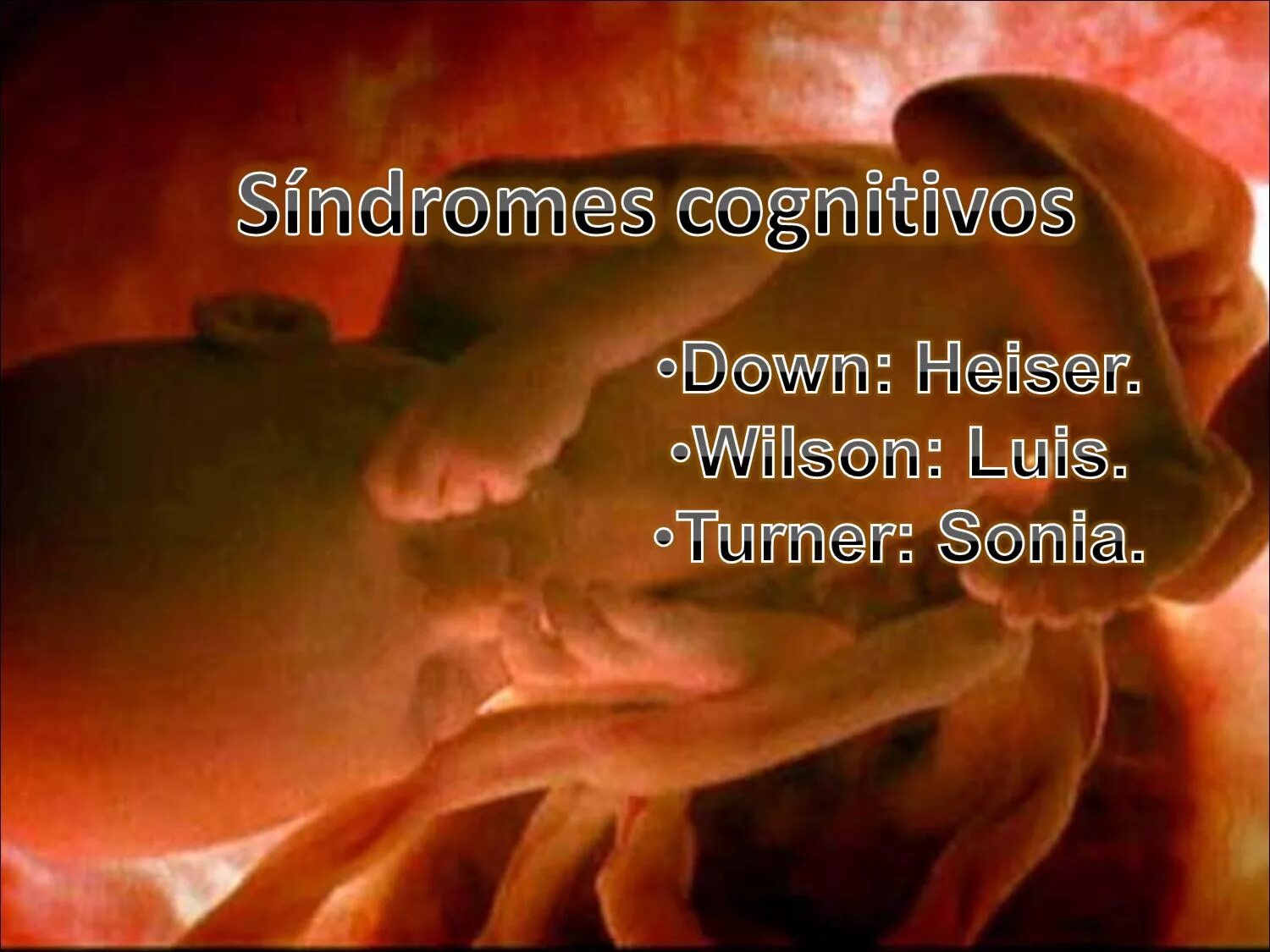 Как выглядит плод на 5 месяце беременности. 6 месяц беременности. Плод 6 месяцев в утробе. Пять детей в животе. Гигантские животы беременных.