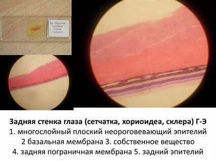 Стенка глаза