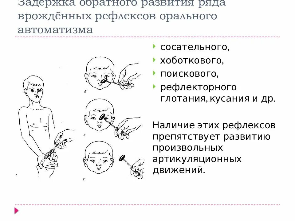 Дцп у новорожденных симптомы. Симптомы дцп у грудничка в 2 месяца. признаки дцп у ребенка в 6 месяцев. врожденные рефлексы орального автоматизма. признаки дцп у ребенка в 3 месяца.