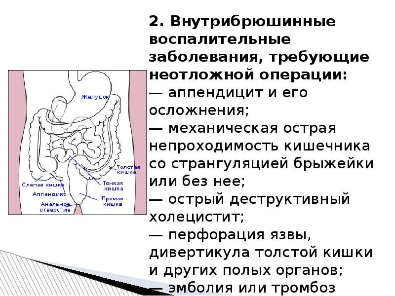 Запор после операции на кишечнике. Непроходимость слепой кишки. Осложнение язвы прямой кишки. Перфорация подвздошной кишки. Приводящий отдел кишечника.